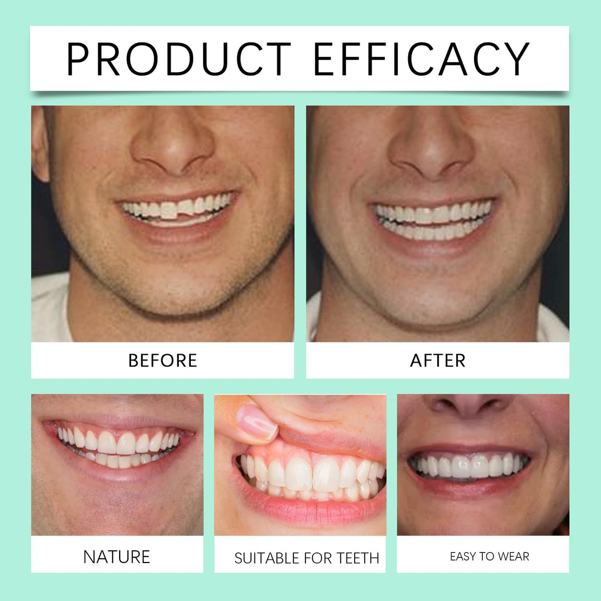 Soft Denture Silicone Veneers, Upper and Lower Denture Set C48884